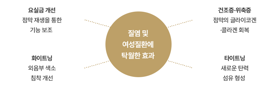중앙 원에 요실금, 건조·위축, 외음부 색소, 탄력 안내를 연결한 네 갈래 도식