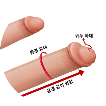음경 둘레 확대·길이 연장·귀두 확대 부위를 표시한 도식