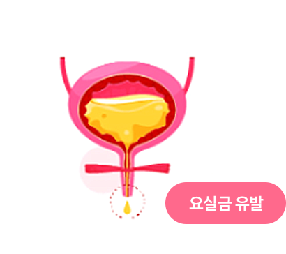 약해진 골반근육과 요도 아래 소변 방울, 요실금 유발 문구가 있는 방광 도식